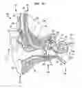 Fig. 03 - Implantable universal docking station for prosthetic hearing devices