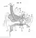 Fig. 04 - Implantable universal docking station for prosthetic hearing devices