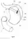 Fig. 07 - Surgical port for notes procedures