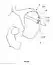 Fig. 08 - Surgical port for notes procedures
