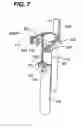 Fig. 08 - Method for performing minimally invasive surgury