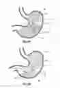 Fig. 06 - Device, system and method for in-vivo imaging of a body lumen