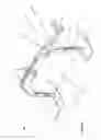Fig. 02 - Apparatus and method for substantially immobilizing a breast for medical imaging procedure