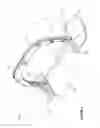 Fig. 03 - Apparatus and method for substantially immobilizing a breast for medical imaging procedure