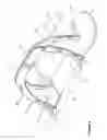 Fig. 04 - Apparatus and method for substantially immobilizing a breast for medical imaging procedure