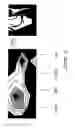Fig. 06 - Non-invasive measuring of load-induced electric potentials in diarthroidial joints