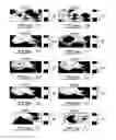 Fig. 08 - Non-invasive measuring of load-induced electric potentials in diarthroidial joints