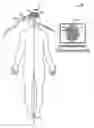 Fig. 01 - SYSTEMS AND METHODS FOR GUIDING A MEDICAL INSTRUMENT