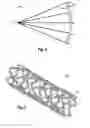 Fig. 03 - SYSTEMS, METHODS, AND APPARATUS FOR IMAGING AN IMPLANTABLE DEVICE AND METHODS FOR MANUFACTURING