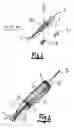 Fig. 02 - Lumen diameter and stent apposition sensing