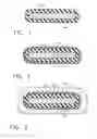 Fig. 02 - Medical assembly suitable for long-term implantation and method for fabricating the same