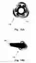 Fig. 15 - Endoluminal medical access device