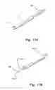Fig. 17 - Endoluminal medical access device