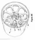 Fig. 04 - Enhanced biomechanical stimulation device
