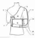 Fig. 01 - Reversible orthosis
