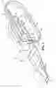 Fig. 02 - Emergency stabilization of a fractured pelvis