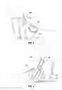 Fig. 03 - Protective braces for joints and associated methods