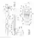 Fig. 02 - Colonic lavage catheter