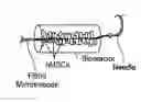 Fig. 01 - MICROTHREAD DELIVERY SYSTEM
