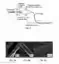 Fig. 03 - MICROTHREAD DELIVERY SYSTEM