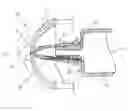 Fig. 01 - SYSTEM FOR INJECTING A FLUID THROUGH OR INTO HUMAN SKIN