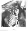 Fig. 04 - Methods for inserting a catheter