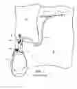 Fig. 02 - METHOD AND APPARATUS FOR SUPPORTING A DRAINAGE BAG