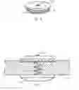 Fig. 06 - Spring-assisted cranial clamp