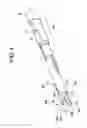 Fig. 05 - Spinal rod approximator