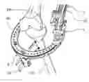 Fig. 01 - Support orthopaedic device for a knee joint