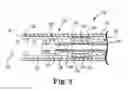 Fig. 08 - Polymer compression joining in implantable lead