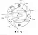 Fig. 35 - Apparatus for securing a therapy delivery device within a burr hole and method for making same