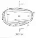 Fig. 04 - Stent and Method of Coating Same
