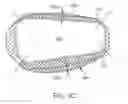 Fig. 06 - Stent and Method of Coating Same