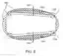 Fig. 09 - Stent and Method of Coating Same