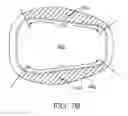 Fig. 11 - Stent and Method of Coating Same