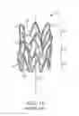 Fig. 15 - Stent and Method of Coating Same