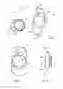 Fig. 03 - Accommodating intraocular lens assemblies and accommodation measurement implant