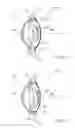 Fig. 05 - Accommodating intraocular lens assemblies and accommodation measurement implant