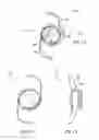 Fig. 06 - Accommodating intraocular lens assemblies and accommodation measurement implant
