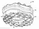 Fig. 01 - Toroid-shaped spinal disc