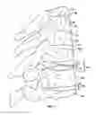 Fig. 02 - Toroid-shaped spinal disc