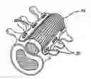 Fig. 01 - Bone anchored surgical mesh