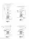 Fig. 06 - Vertebral prosthesis and spinal fixation system