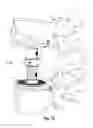 Fig. 10 - Vertebral prosthesis and spinal fixation system