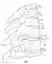 Fig. 02 - TOROID-SHAPED SPINAL DISC