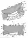 Fig. 06 - TOROID-SHAPED SPINAL DISC