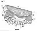 Fig. 07 - TOROID-SHAPED SPINAL DISC