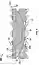 Fig. 09 - TOROID-SHAPED SPINAL DISC