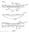 Fig. 10 - TOROID-SHAPED SPINAL DISC